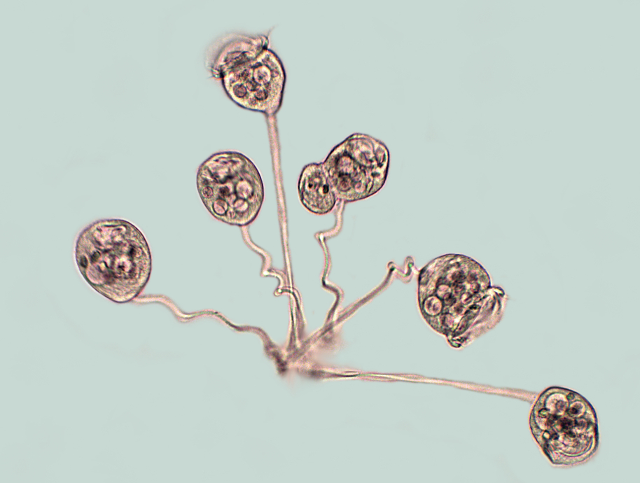Vorticella